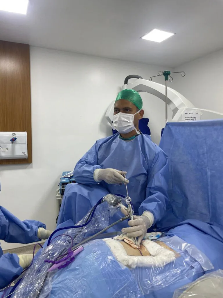 Dr Juan Aquino realizando Cirurgia Minimamente Invasiva de Endoscopia (Vídeo-Cirurgia) para Retirada de Hérnia de Disco. Cicatriz de 1 centímetro, alta hospitalar no mesmo dia e retorno ao trabalho em 7 dias.