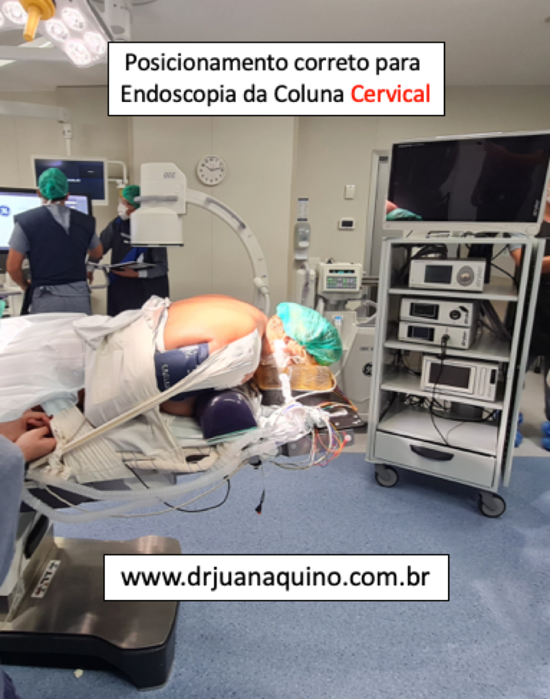 Psocopnamento correto do paciente para endoscopia da coluna Cervical - Dr Juan Aquino. www.drjuanaquino.com.br