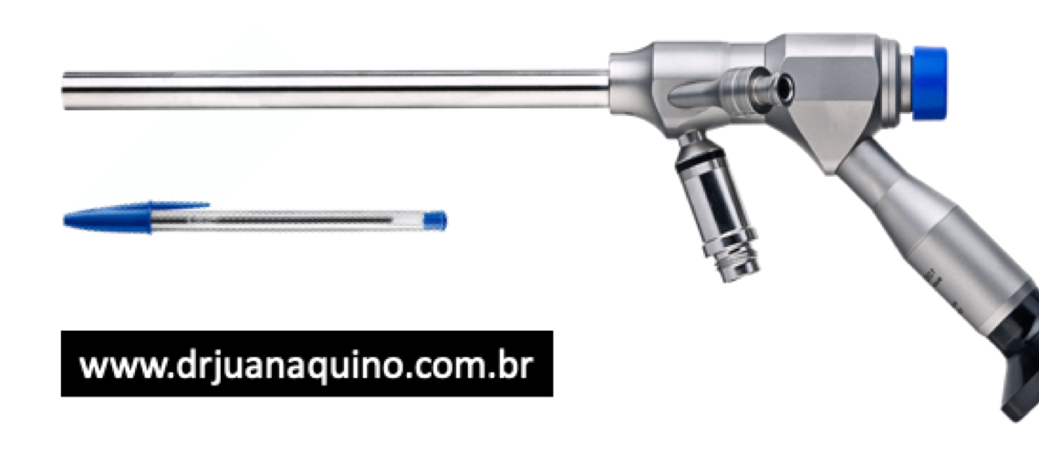 Comparação entre o tamanho do endoscópio utilizado na cirurgia da coluna e uma caneta