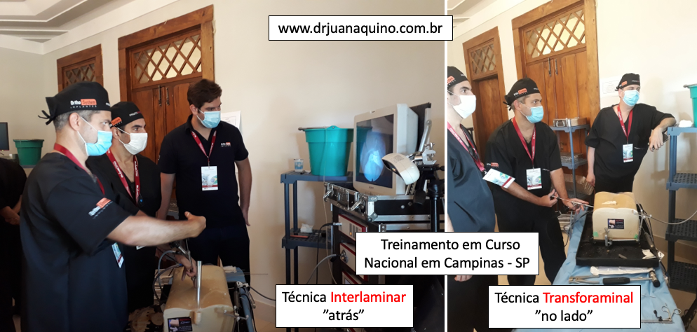 Treinamento em Cuso Nacional Camponas SP Coluna Lombar - Dr Juan Aquino. www.drjuanaquino.com.br