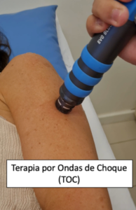 Terapia por Ondas de Choque. Dr Juan Aquino www.drjuanaquino.com.br