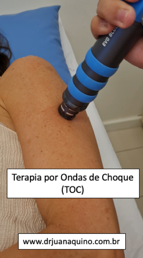 Terapia por Ondas de Choque. Dr Juan Aquino www.drjuanaquino.com.br