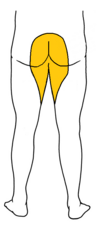 sindrome da cauda equina